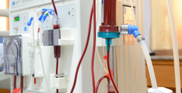 Dialysis Machines